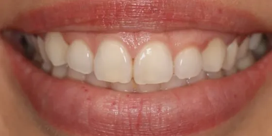 Antes: la sonrisa de una paciente