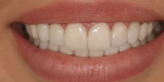Después: la sonrisa de una paciente
